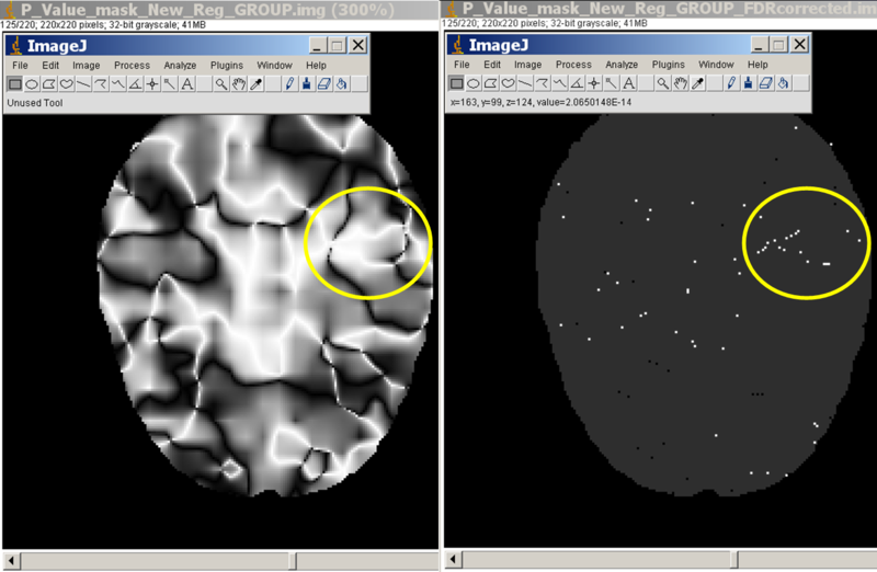 File:SOCR Analyses FDR Volume 051309.png